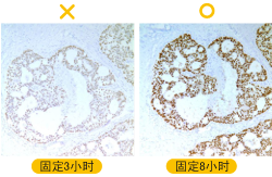 IHC问题排除(一)-6个IHC型态不佳该做的事