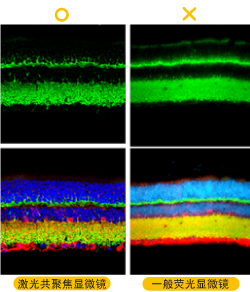 IHC问题排除(一)-6个IHC型态不佳该做的事