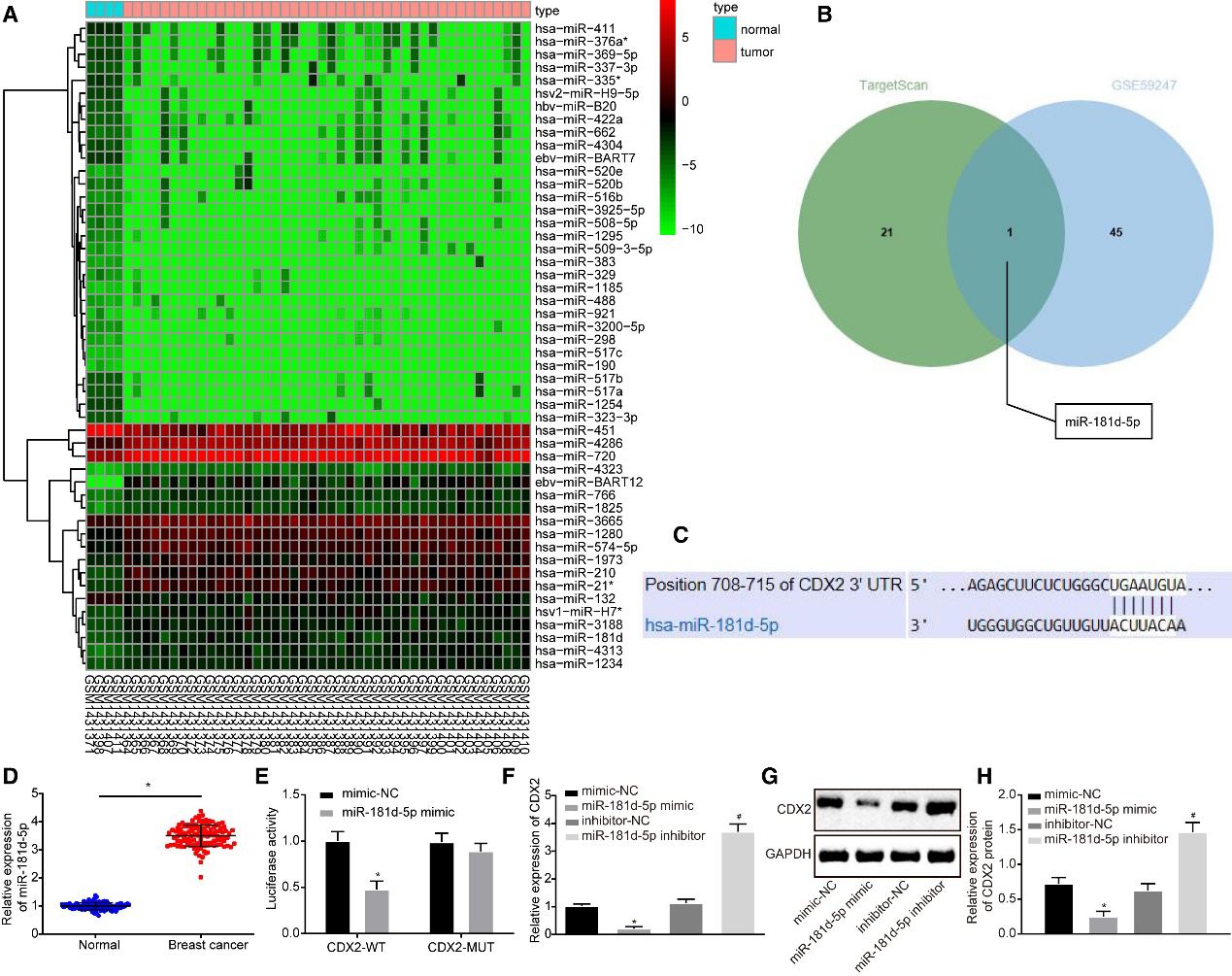 CAFs释放的含microRNA-181d-5p的外泌体通过调节乳腺癌中CDX2\HOXA5促进EMT