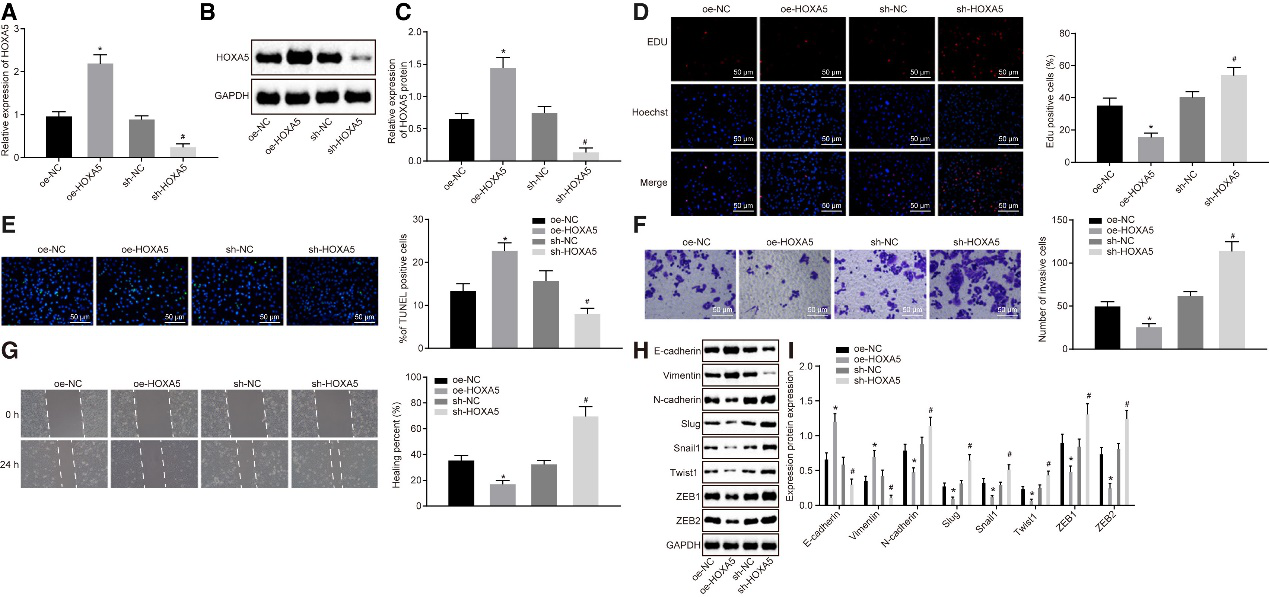CAFs释放的含microRNA-181d-5p的外泌体通过调节乳腺癌中CDX2\HOXA5促进EMT