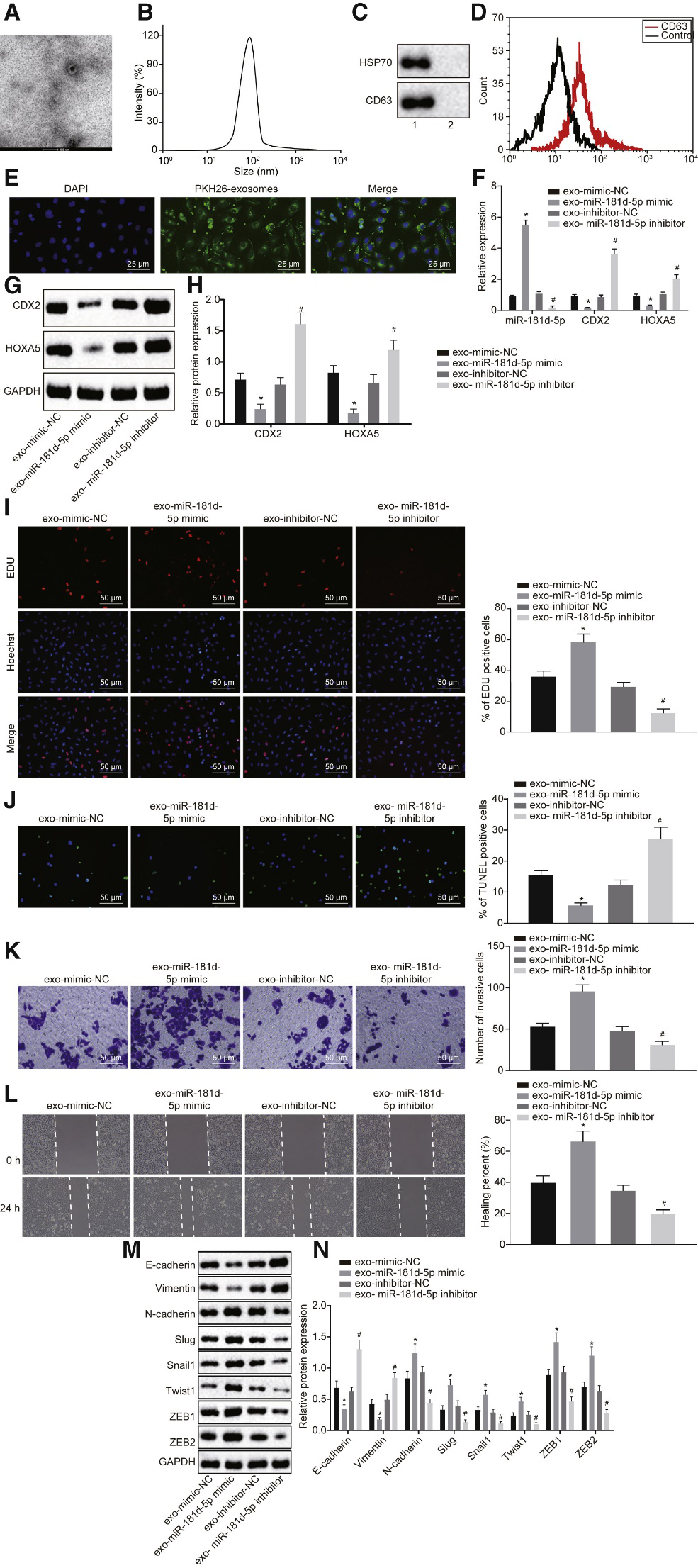 CAFs释放的含microRNA-181d-5p的外泌体通过调节乳腺癌中CDX2\HOXA5促进EMT