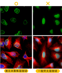 IHC问题排除(一)-6个IHC型态不佳该做的事