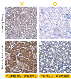 Ihc问题排除 二 6个ihc高背景值该做的事 企业动态 丁香通