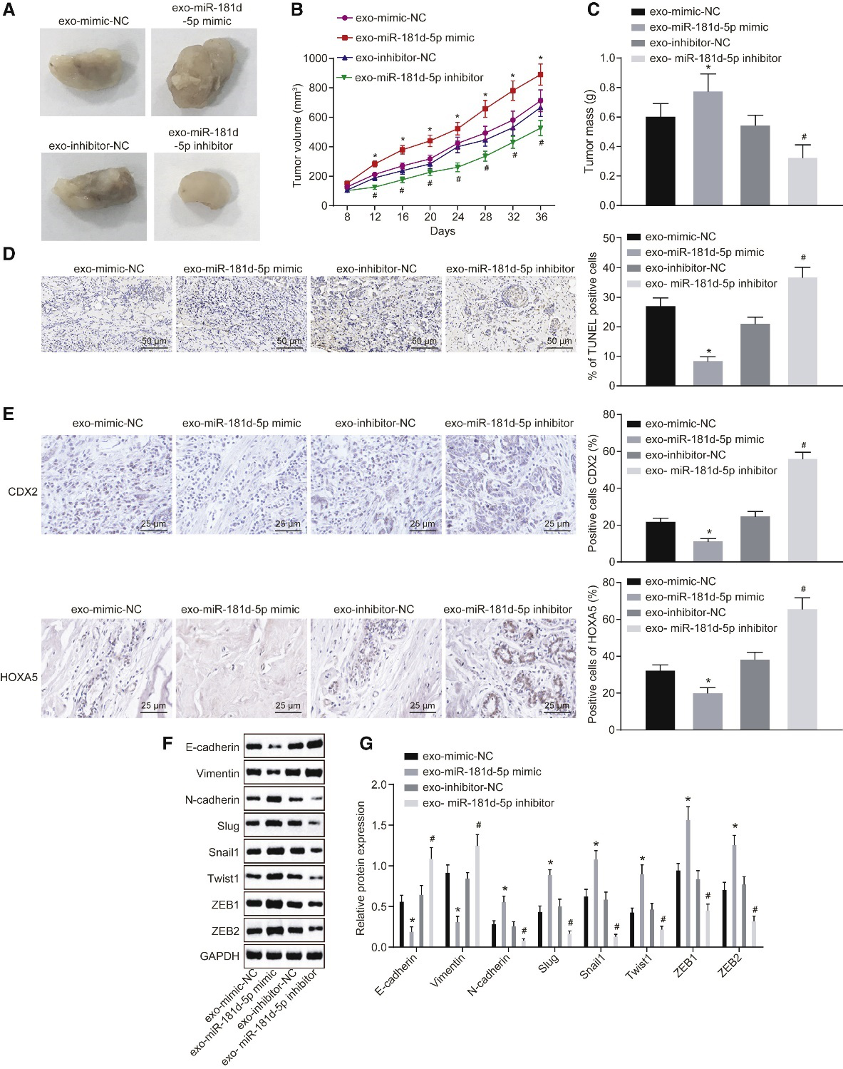 CAFs释放的含microRNA-181d-5p的外泌体通过调节乳腺癌中CDX2\HOXA5促进EMT