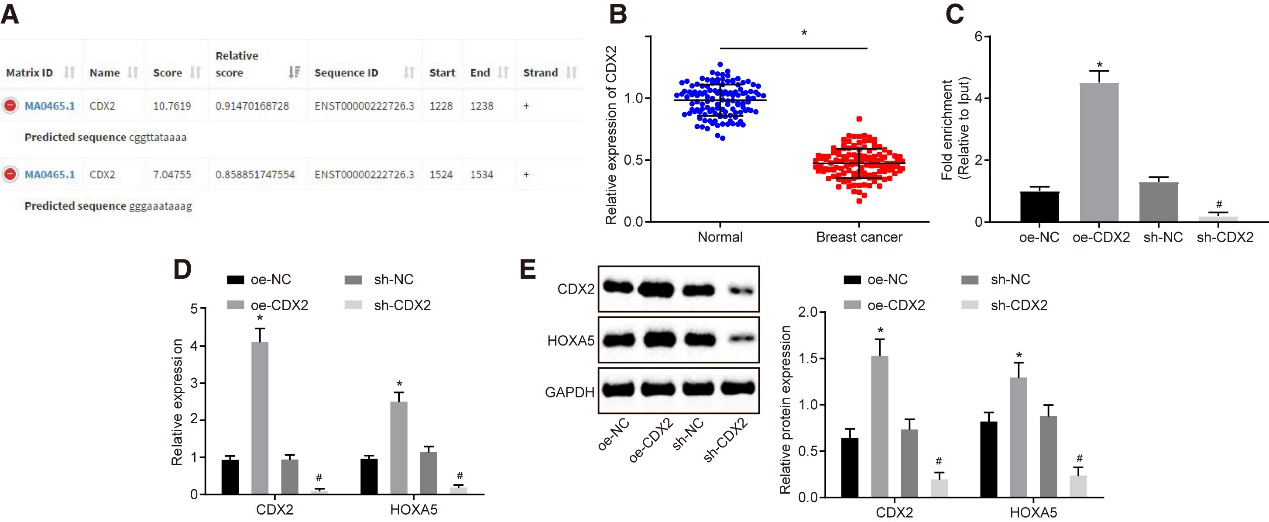 CAFs释放的含microRNA-181d-5p的外泌体通过调节乳腺癌中CDX2\HOXA5促进EMT