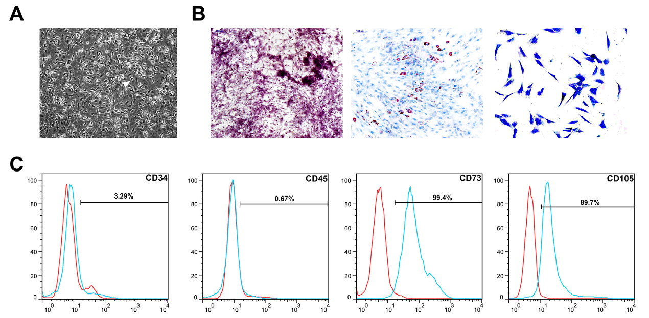 缺氧下MSC细胞分泌的携带miR-216a-5p外泌体可通过调控小胶质细胞M1/M2极化修复外伤性脊髓损伤