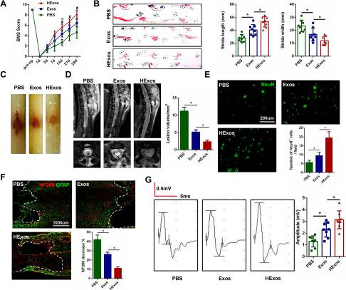 缺氧下MSC细胞分泌的携带miR-216a-5p外泌体可通过调控小胶质细胞M1/M2极化修复外伤性脊髓损伤