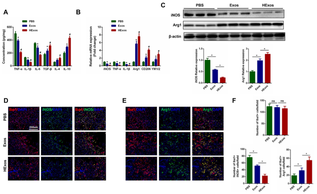 缺氧下MSC细胞分泌的携带miR-216a-5p外泌体可通过调控小胶质细胞M1/M2极化修复外伤性脊髓损伤