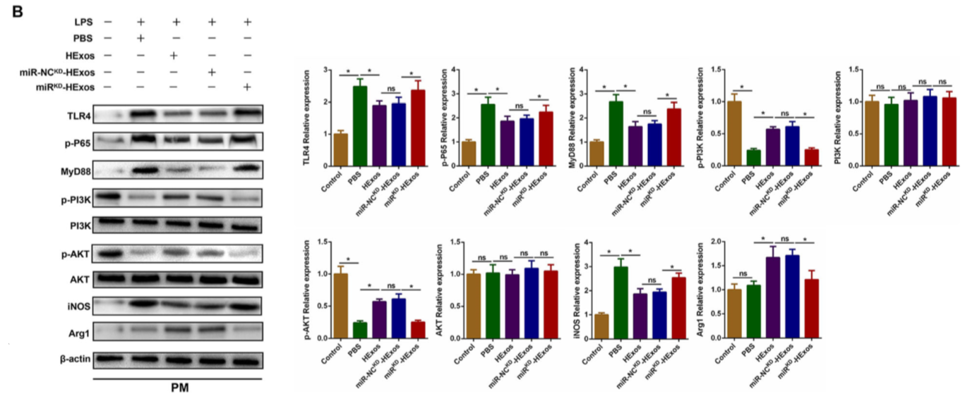 缺氧下MSC细胞分泌的携带miR-216a-5p外泌体可通过调控小胶质细胞M1/M2极化修复外伤性脊髓损伤