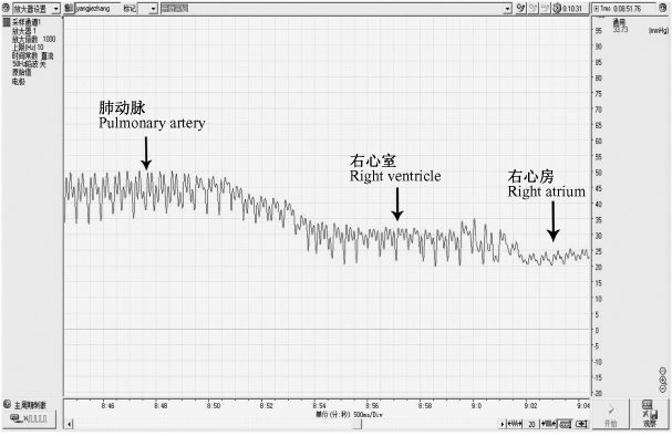 大小鼠肺动脉高压模型