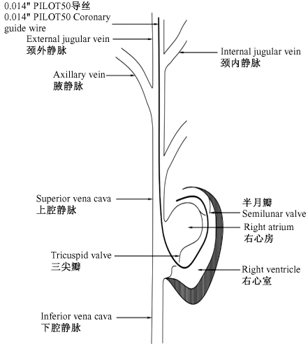 大小鼠肺动脉高压模型