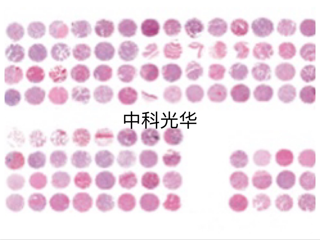 病理 AI 诊断精准标记组织芯片