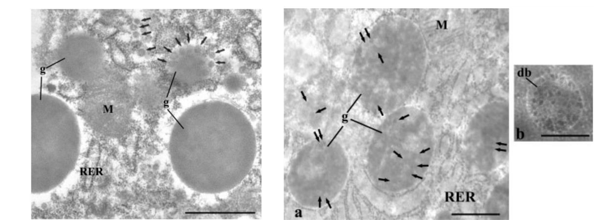 专题推荐 | 低压透射电子显微镜LVEM在病毒学研究中的应用