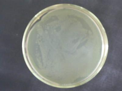 乳酸菌/双歧杆菌显色培养基