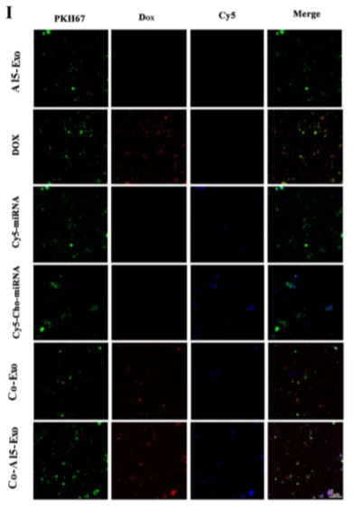 功能性外泌体介导的阿霉素和疏水修饰的microRNA 159共递送，可用于三阴性乳腺癌治疗