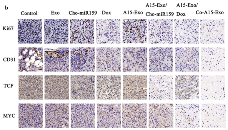 功能性外泌体介导的阿霉素和疏水修饰的microRNA 159共递送，可用于三阴性乳腺癌治疗