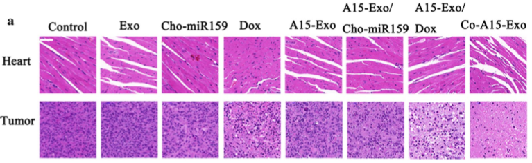 功能性外泌体介导的阿霉素和疏水修饰的microRNA 159共递送，可用于三阴性乳腺癌治疗