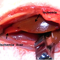 2/3肝缺血再灌注（HIRI）动物模型
