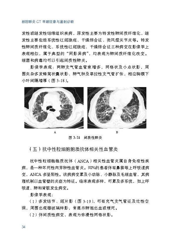 浙江省《新冠肺炎 Ct 早期征象与鉴别诊断》出版并免费共享 － 丁香园 0145