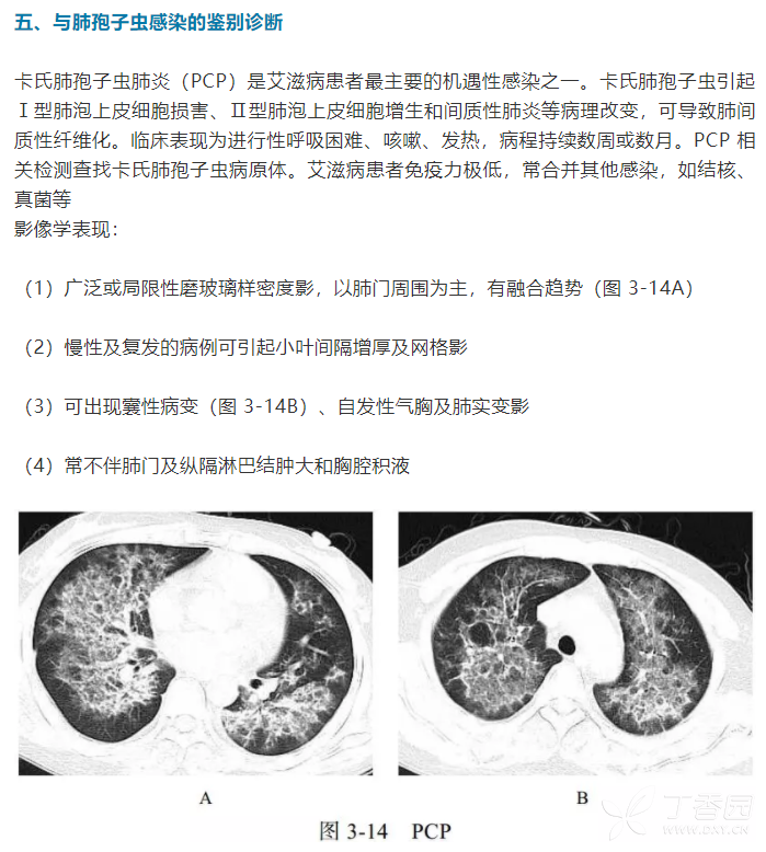 新冠肺炎肺部影像图片图片