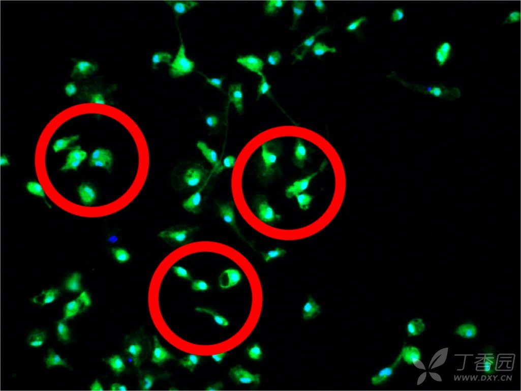 原代小胶质细胞培养经验
