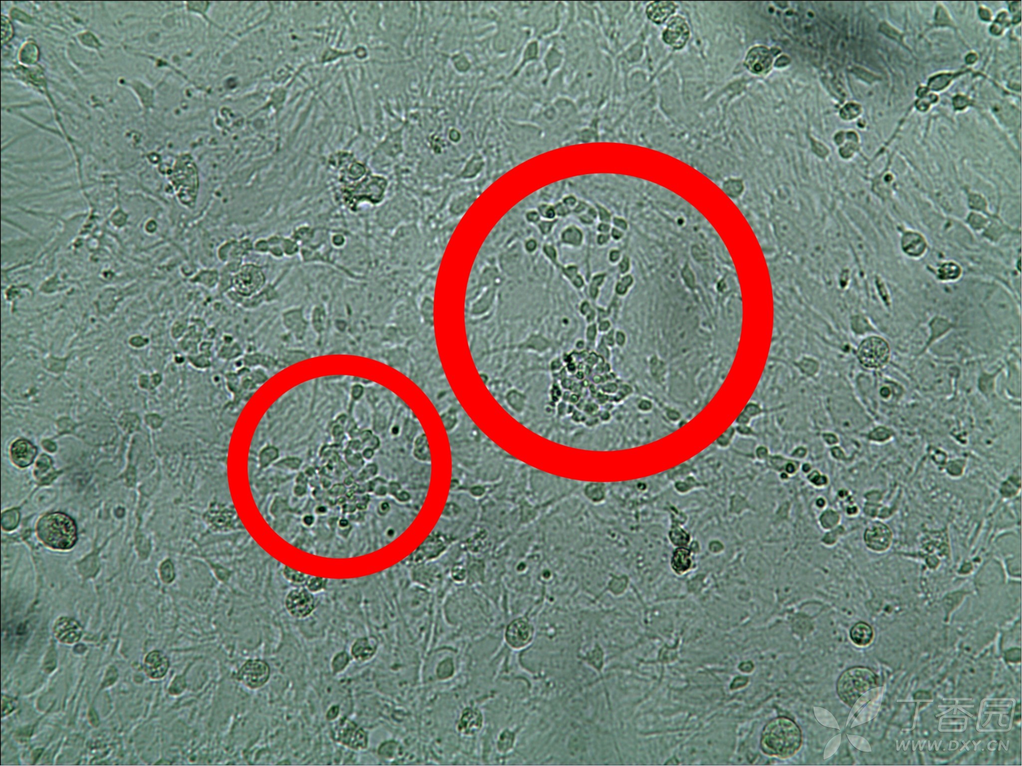原代小胶质细胞培养经验