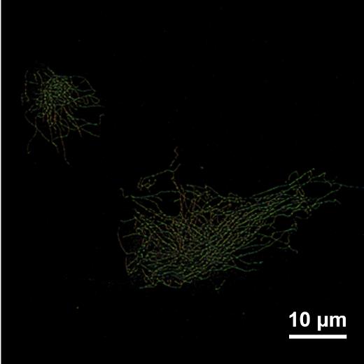 大视野单分子超分辨模块-SAFe 180