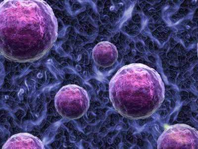 人卵巢癌多药耐药细胞形态