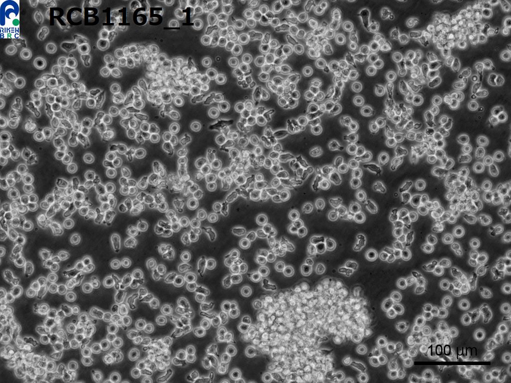 YAC-1【Yac-1; YAC】小鼠淋巴瘤细胞(NK靶细胞