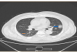 A deep learning algorithm using CT images to screen for Corona  Virus Disease (COVID-19)