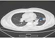 文献解读 | 一项使用 CT 图像筛选冠状病毒疾病（COVID-19）的深度学习算法