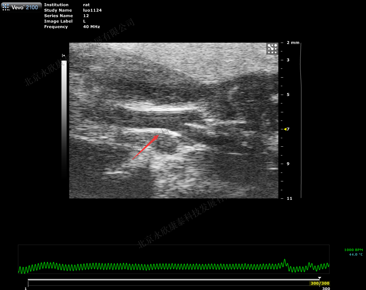 大鼠颈动脉球囊损伤、斑块、动脉硬化模型