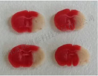 大鼠脑卒中（MCAO）脑缺血再灌注模型