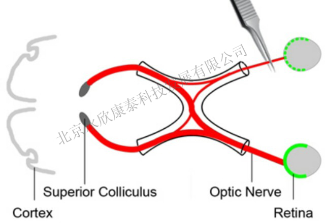 视神经钳夹损伤致青光眼模型（ONC） 