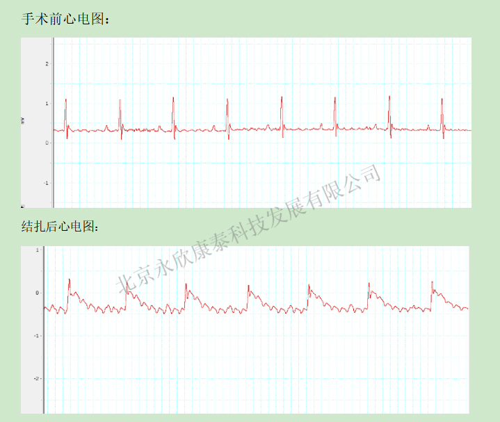 大小鼠心梗模型(MI)