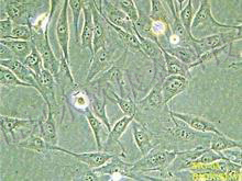 人纤维肉瘤HT-1080细胞株SCID小鼠移植模型