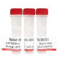 胶体金标记山羊抗人Ig抗体(金标二抗)北京品牌