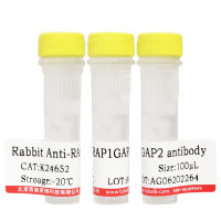 羊抗人IgM(μ链特异)-HRP报价