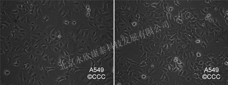 人肺腺癌A-549细胞株SCID小鼠移植模型