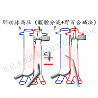 动静脉造瘘分流致肺动脉高压模型