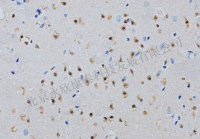 病理服务—TUNEL染色（DAB\荧光）