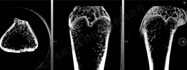 骨质疏松大鼠、小鼠动物模型