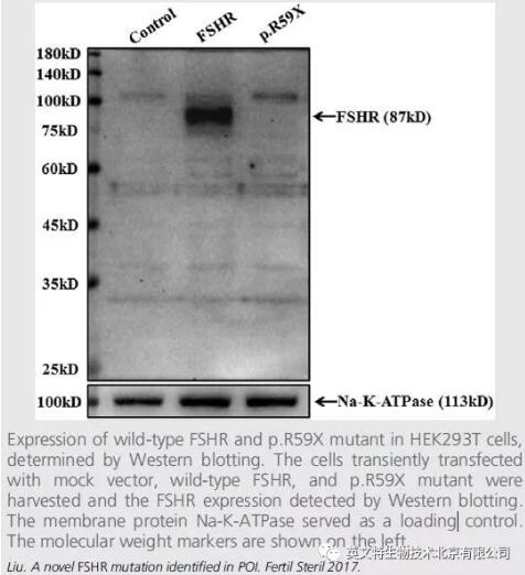 跨膜蛋白提取无从下手？1小时完成不是梦想！