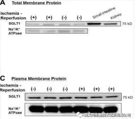 跨膜蛋白提取无从下手？1小时完成不是梦想！