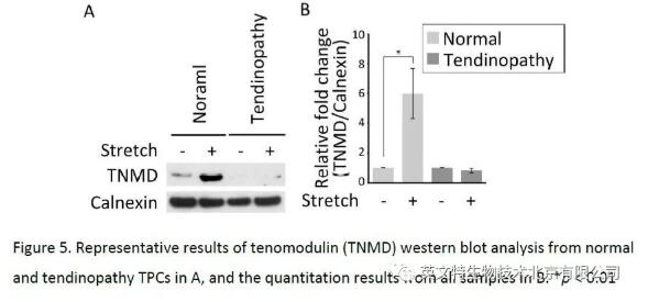 跨膜蛋白提取无从下手？1小时完成不是梦想！