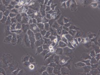 Hep-2【Hep-2; HEP-2; Hep 2; Hep2; HEp2; HEP2; H.Ep.-2; H.Ep. #2; H.Ep. No. 2; Hep II; Human Epidermoid carcinoma #2; Human Epithelioma-2】喉表皮样癌细胞