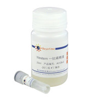 Phospho-FoxO1 (Thr24)/FoxO3a(Thr32)抗体(兔多抗)