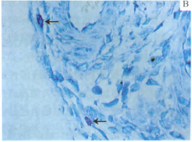 膀胱炎动物模型