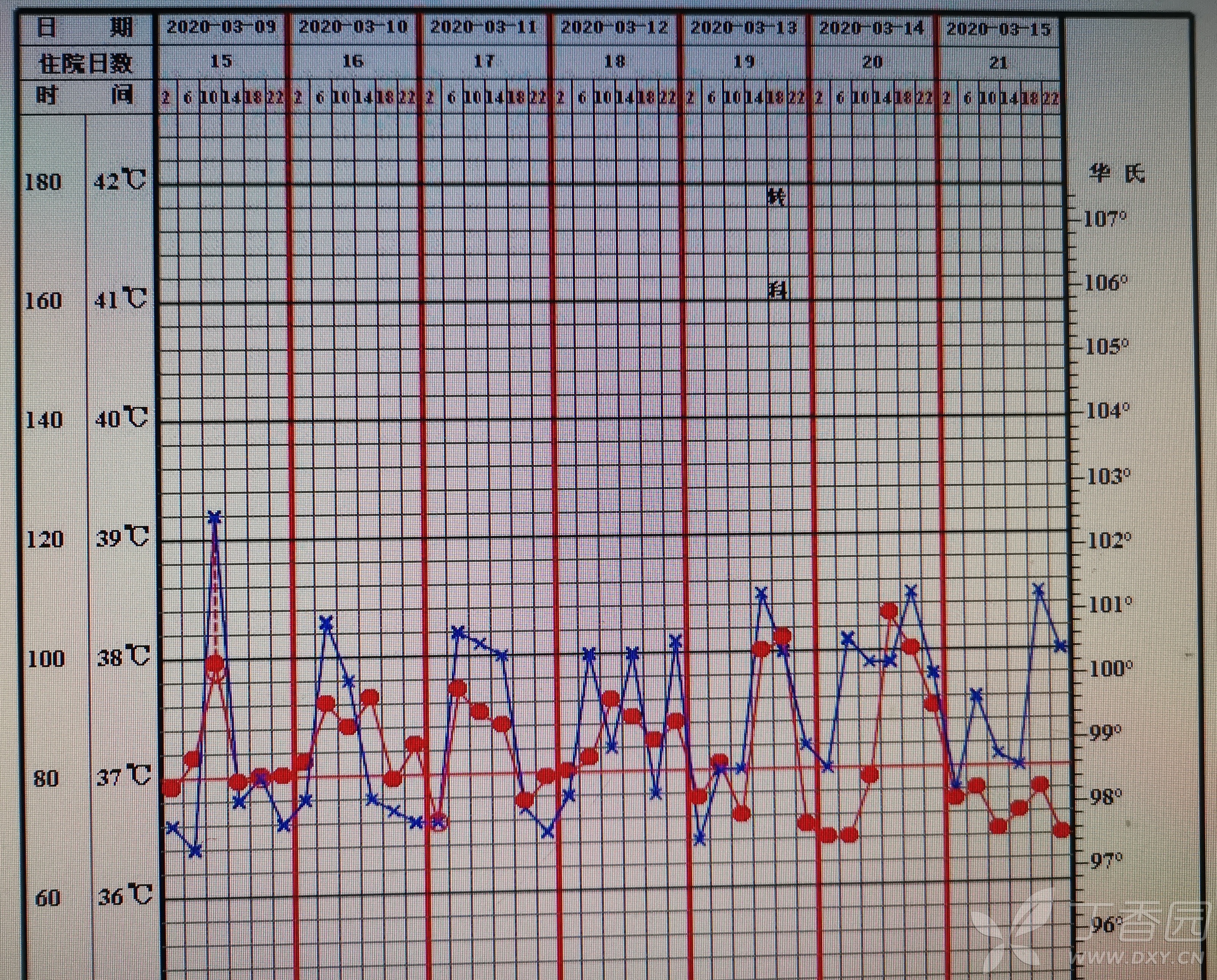 【求助】一例腰大肌脓肿病人的诊治(重点求助下脓肿