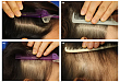 临床回顾：女性型脱发的临床特征